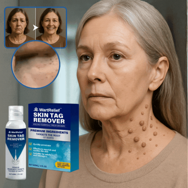 Sakome™ Crème anti-verrues | Une peau lisse et sans verrues pour toujours  - dans 4 jours !